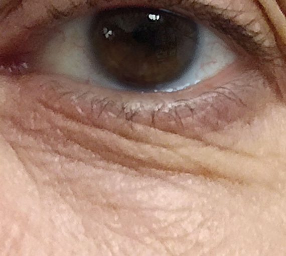 b-selfie eye il primo filler fai da te 7 karismashop