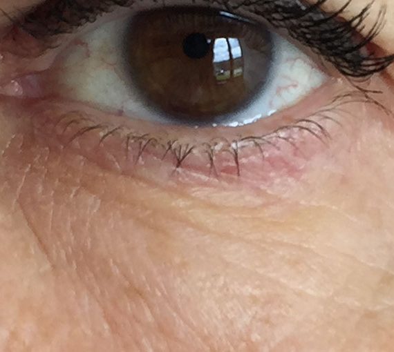 b-selfie eye il primo filler fai da te 8 karismashop